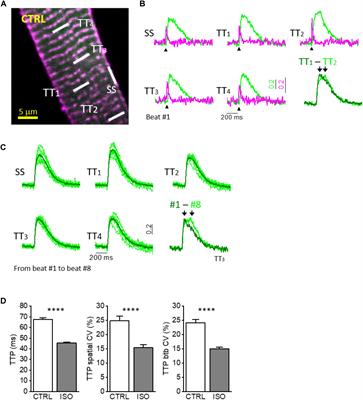 Interplay Between Sub-Cellular Alterations of Calcium Release and T-Tubular Defects in Cardiac Diseases